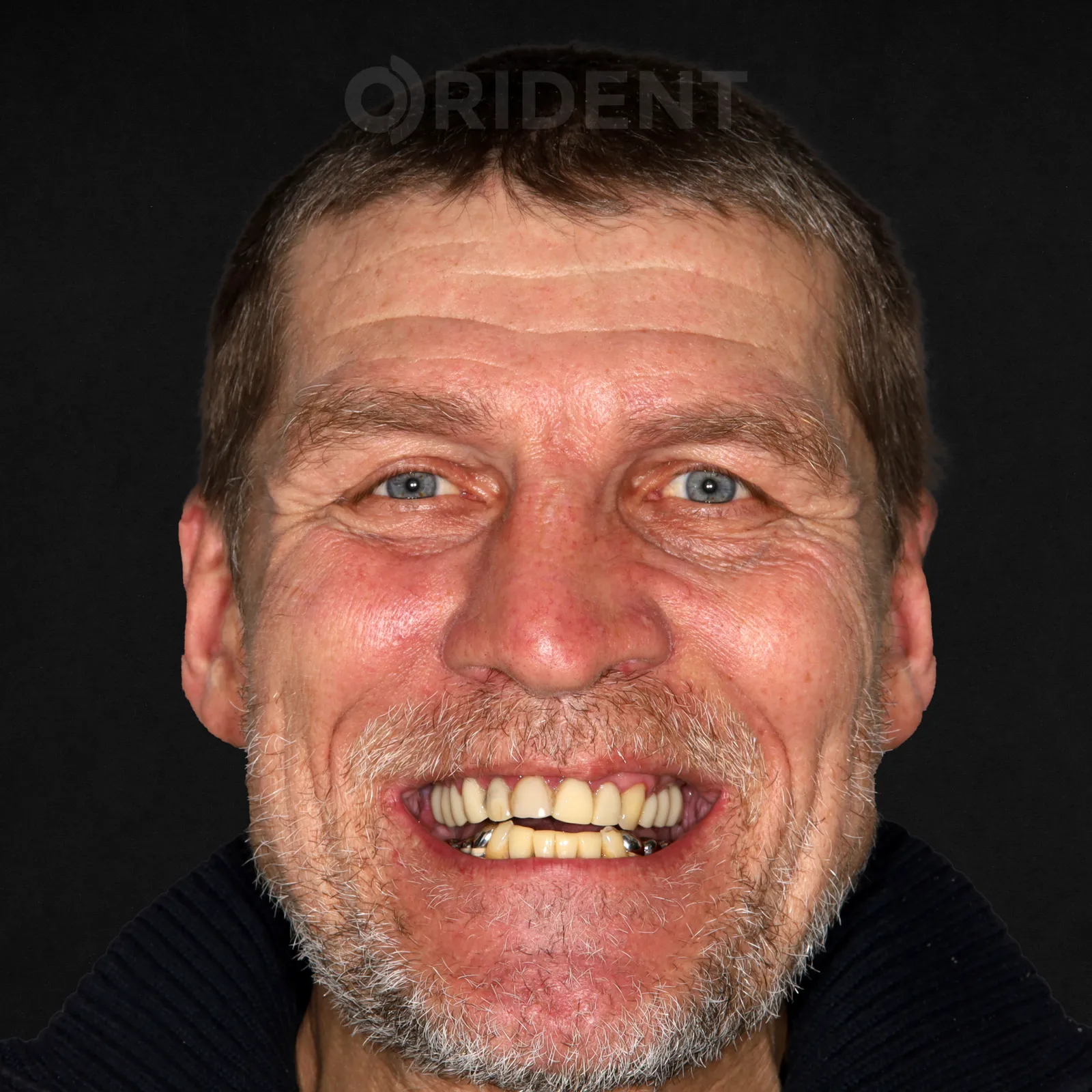 Алексей после лечения